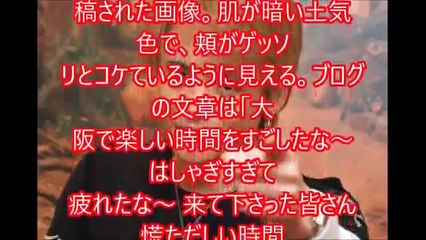 【閲覧注意】諸星和己 光GENJI 現在 画像がヤバすぎる…激やせが想像以上 薬物疑惑も… 【悲報】スマップ 解散 ９月 確定か！？香取慎吾の親友 山本耕史が暴露！？ チャンネル登
