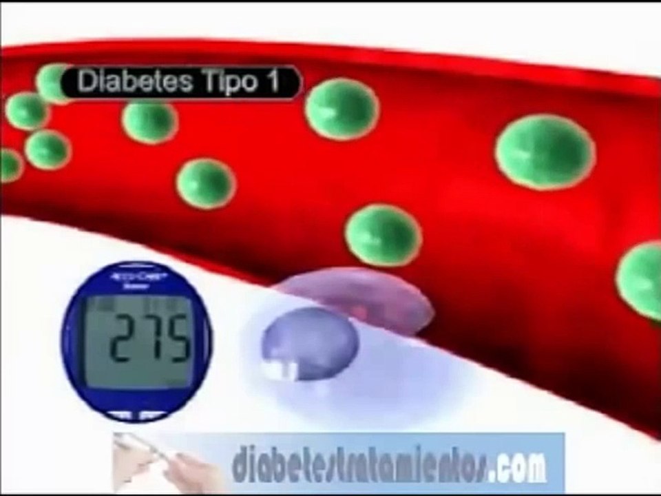 Que es la diabetes mellitus - Diferencias entre la diabetes tipo 1 y diabetes tipo 2