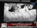 Dalagang may pyoderma gangrenosum, naipagamot ng GMA Kapuso Foundation noong 2013