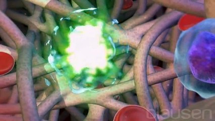 Chemotherapy medical animation