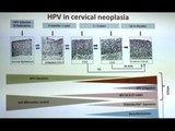 Napoli - Hpv, test e vaccini per sconfiggere il virus: medici a confronto (01.04.17)