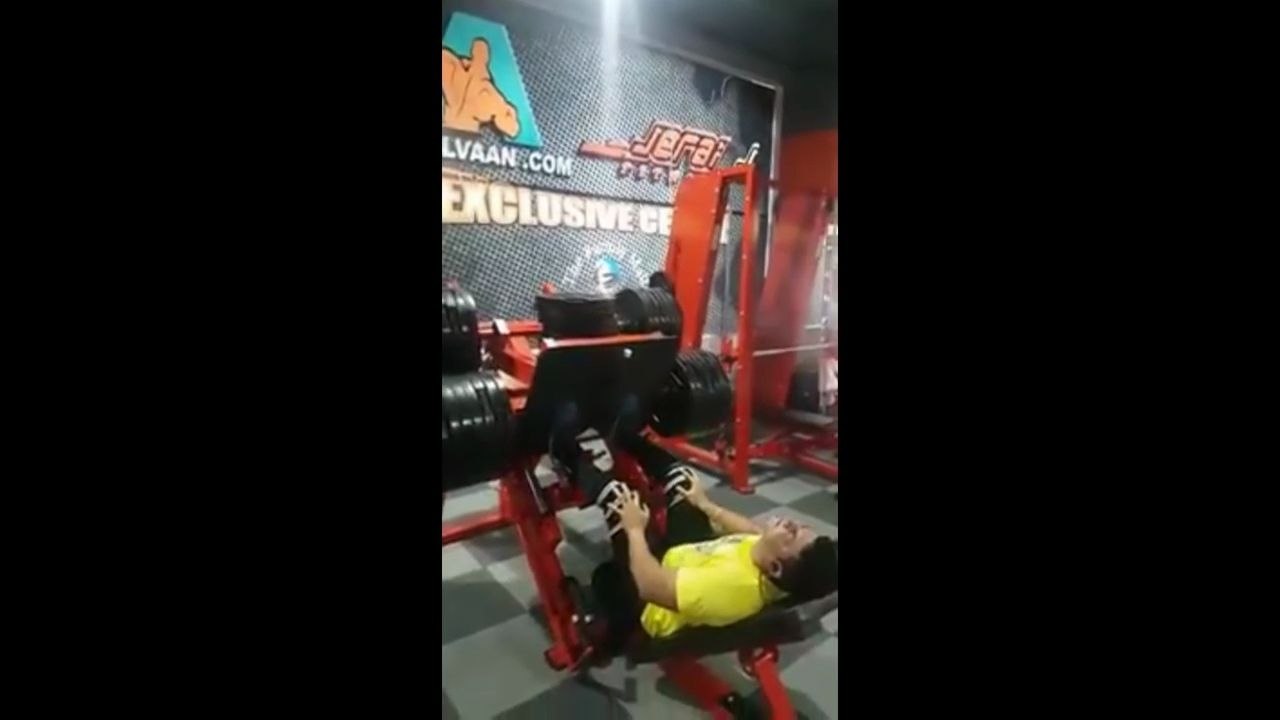 Un bodybuildeur se casse une jambe sur une presse à cuisses.