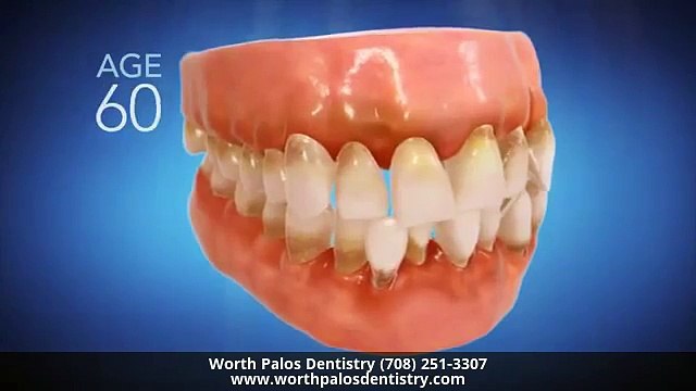 Invisalign Dentist Palos Hills IL