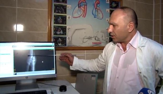 BACAĞI KIRILAN DEVEKUŞU, ERÜ VETERİNER FAKÜLTESİ HASTANESİ’NDE TEDAVİ EDİLDİ
