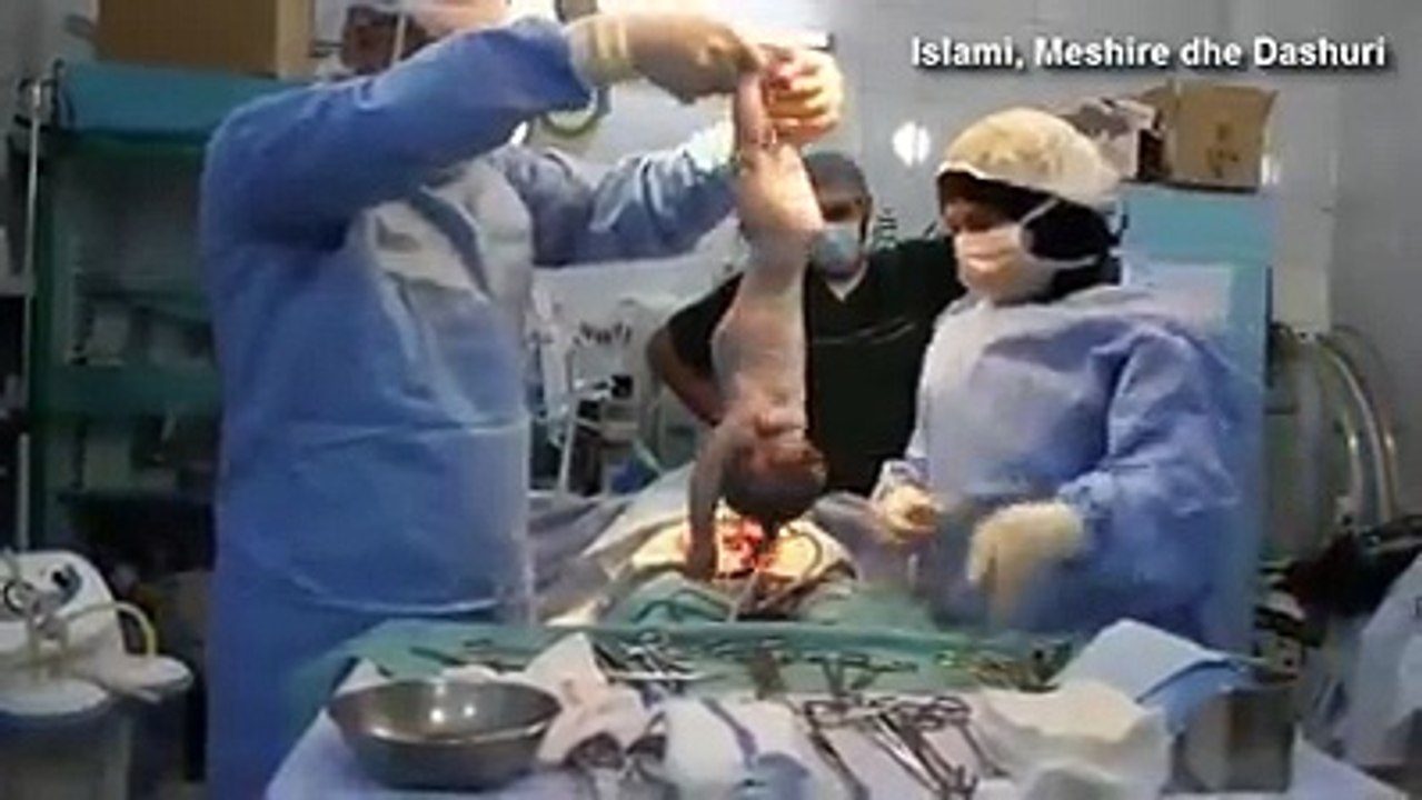 Newborn baby was saved miraculously
