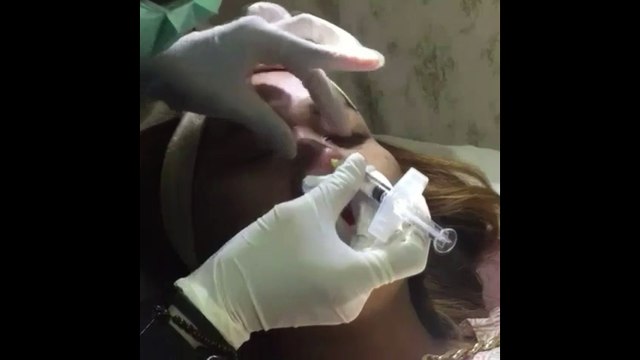 0811 1721 280, Agar wajah Putih di Jakarta Selatan Rinanda Skin Care Center