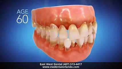 Invisalign Dentist Orlando FL