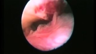 Human ovulation captured on film http://BestDramaTv.Net