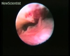 Human ovulation captured on film http://BestDramaTv.Net