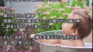 俺「息子に濃い痣が。嫁が○待してるもしれない」→嫁は○待児だったから○待の連鎖になっているかも…