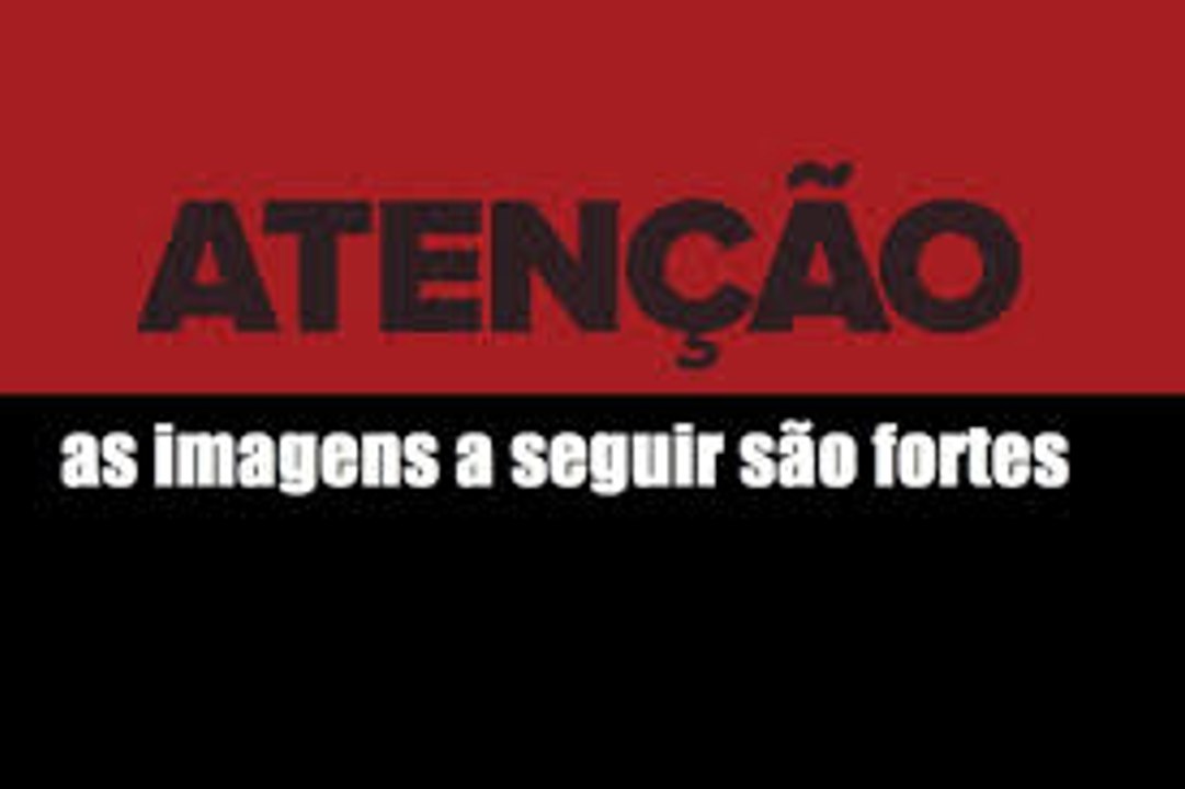 Acidente de mota  - Imagens fortes !!