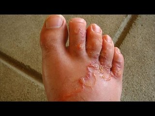 Sức Khỏe vs 5 món ăn chứa CẢ Ổ GIUN SÁN 4 món có trong bữa cơm của người Việt mỗi ngày