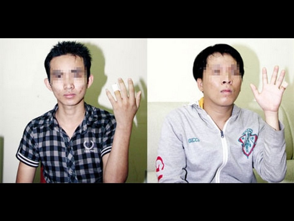 Hôm nay có gì? - Điều tra vụ thua bạc bị chặt ngón tay ở sòng bạc Campuchia