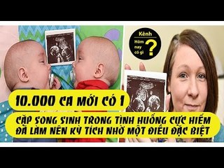 ✔ Hôm nay có gì? - 10.000 ca mới có 1, cặp song sinh trong tình huống cực hiếm đã làm nên kỳ tích