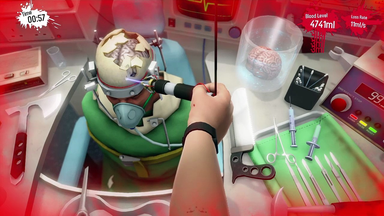 This Game is Hard!!|Surgeon simulator