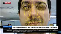 Quand la reconnaissance faciale détecte une maladie génétique rare !