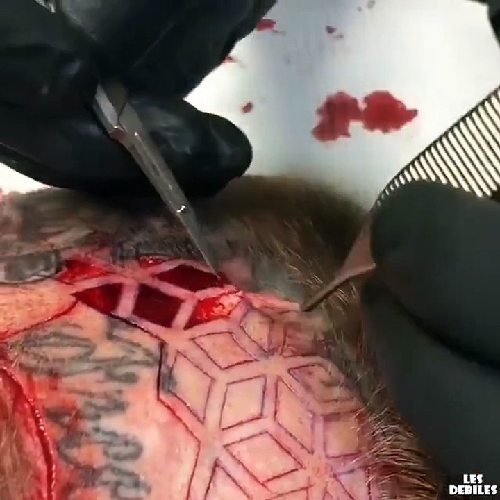 Le tatouage nouvelle génération... Au scalpel - Vidéo Dailymotion