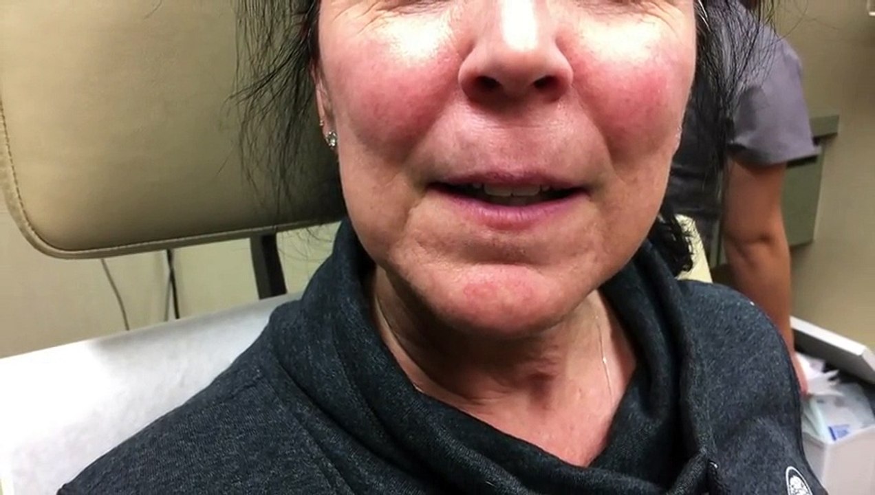 Elle se fait retirer un point noir monstrueux logé dans sa lè supé