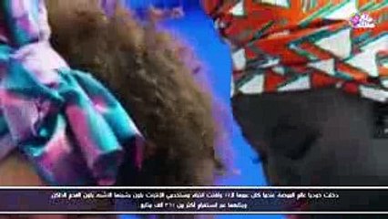 5 فتيات يمتلكن أغرب لون بشرة فى العالم !