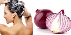 Fast Hair Regrowth, Hair Loss, Long & Thick Hair with Onion Hair Oil || Home Remedies