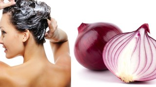 Fast Hair Regrowth, Hair Loss, Long & Thick Hair with Onion Hair Oil || Home Remedies