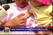 Carapongo: niños presentan diversas afecciones a la piel tras huaico