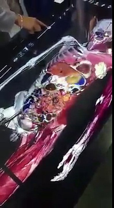 C.T Scan, MRI, X'RAYS  ka gaya zamana. Ab aa gayi naye zamana ki nayi digital technology. Now Doctors can see your body live through and through on screen. Look at here.