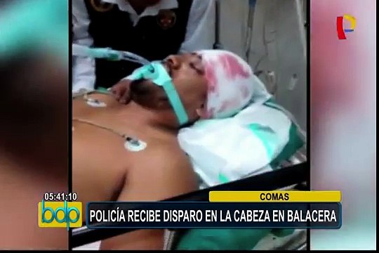 Comas: policía resulta gravemente herido tras balacera con delincuentes