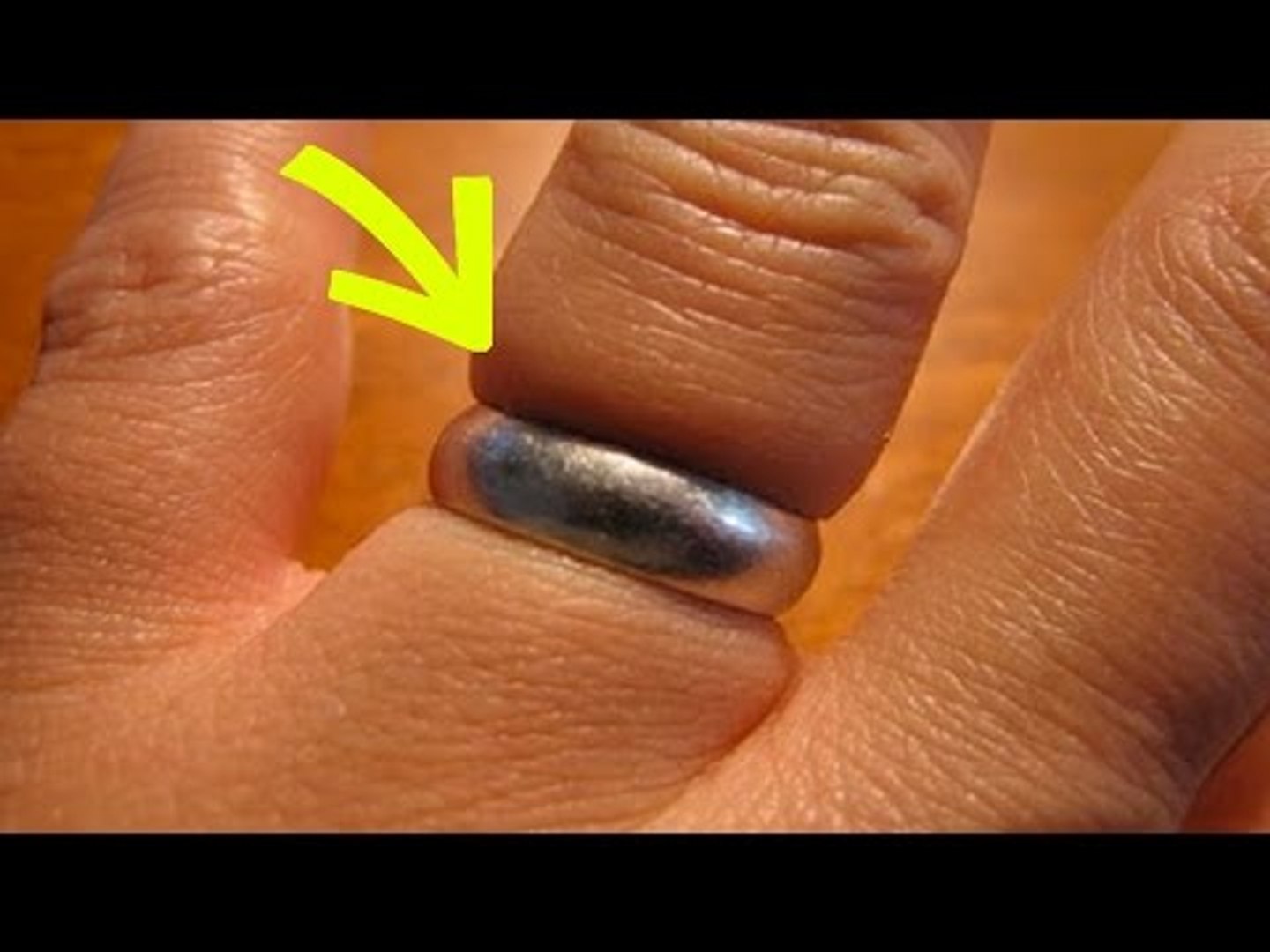 Comment Enlever Une Bague Trop Serrée - Vidéo Dailymotion