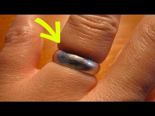 Comment Enlever Une Bague Trop Serrée - Vidéo Dailymotion