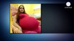 Cette jeune femme de 23 ans croyait être enceinte de jumeaux, mais quand le docteur lui montre l’échographie…