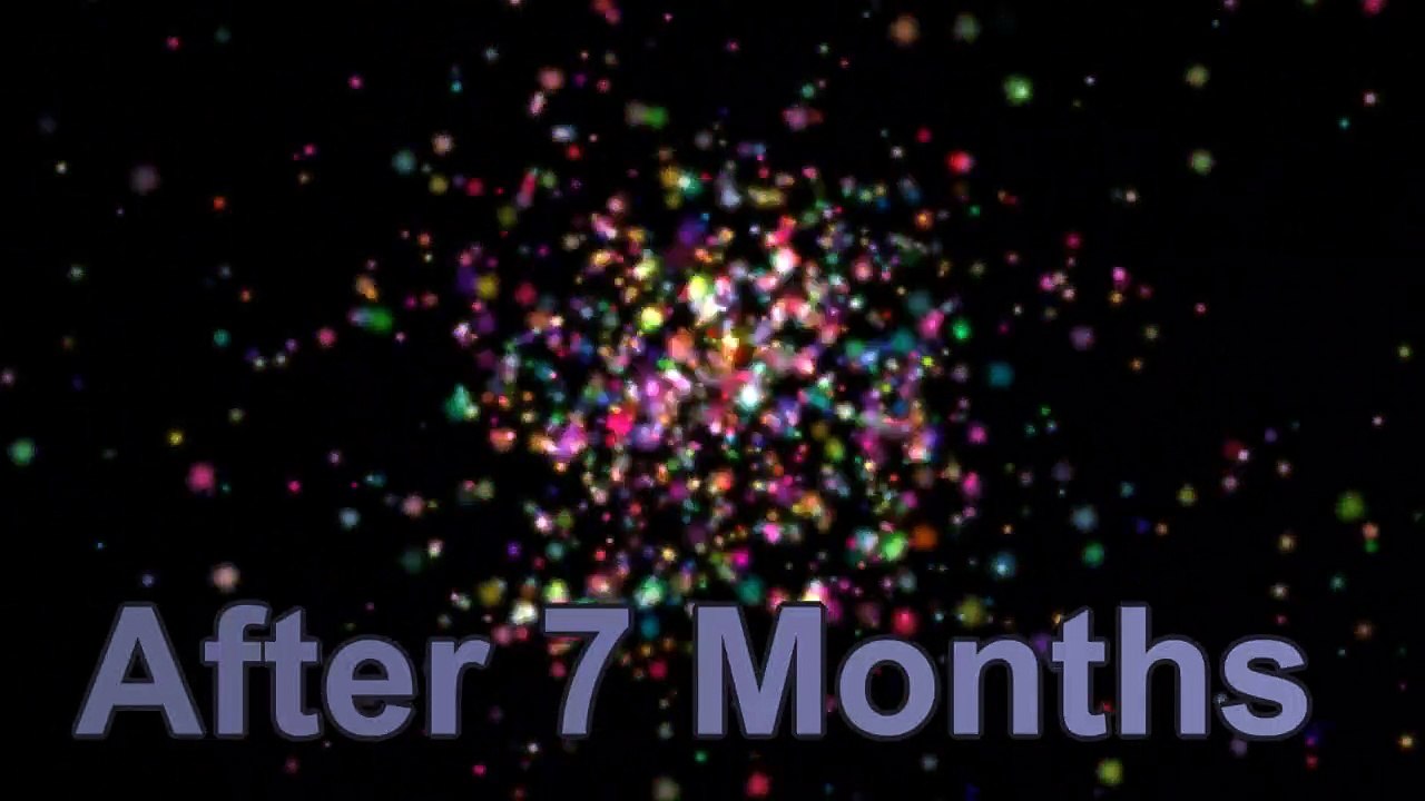 Hair Transplant Delhi Before After 5500 Grafts by Dr. Dutt Hair Transplant Center