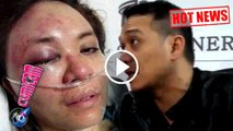 Hot News! Adik Korban Kekerasan, Fadlan Ingin Balas Dendam? - Cumicam 07 April 2017