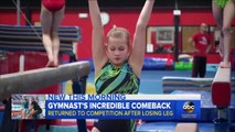 Cette gymnaste amputée d'une jambe a un incroyable talent