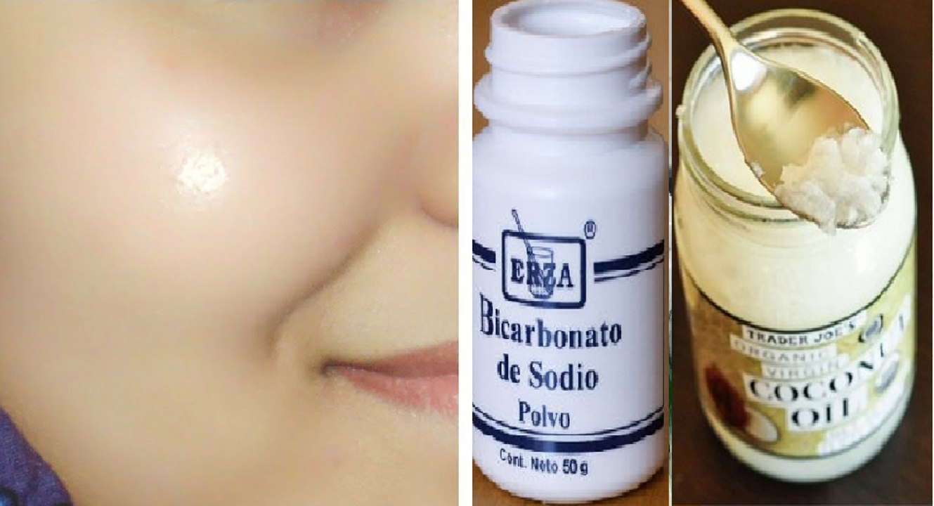 ÓLEO DE COCO E BICARBONATO- Receita mágica para APAGAR RUGAS,MANCHAS e OLHEIRAS!