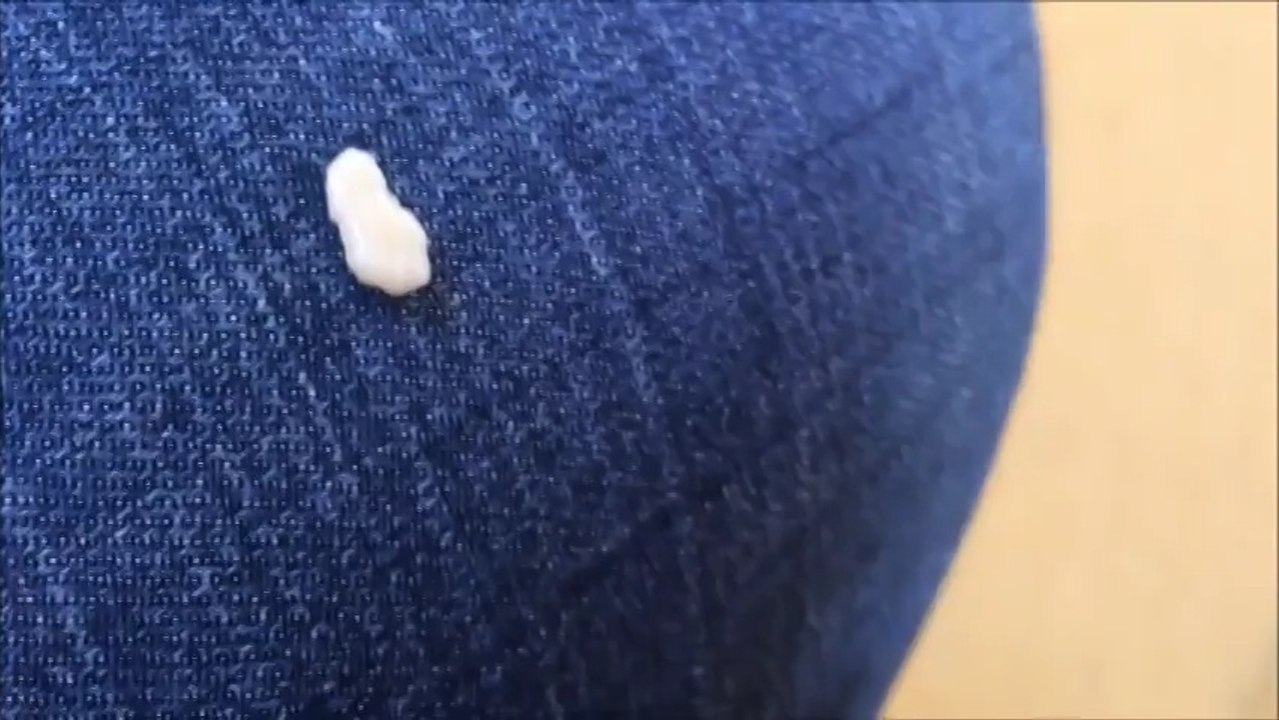 Ağız Kokusunun Asıl Sebebi İşte Buymuş.. Hemen Aynaya Koşacaksınız!