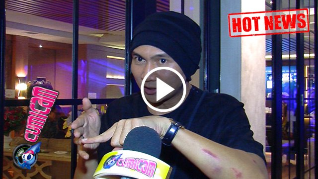 Hot News! Anji Luka Berdarah, Anak-anak Ketakutan - Cumicam 08 April 2017
