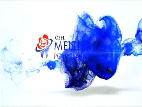 İmplant Diş tedavisi nasıl yapılır?