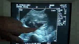 Baby - Is it a Boy or Girl....must watch