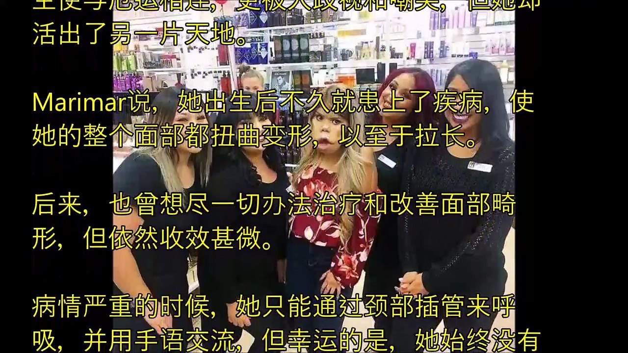 女孩從小染怪病臉部變形，如今是擁有120萬粉絲美妝博主！而現在卻又..