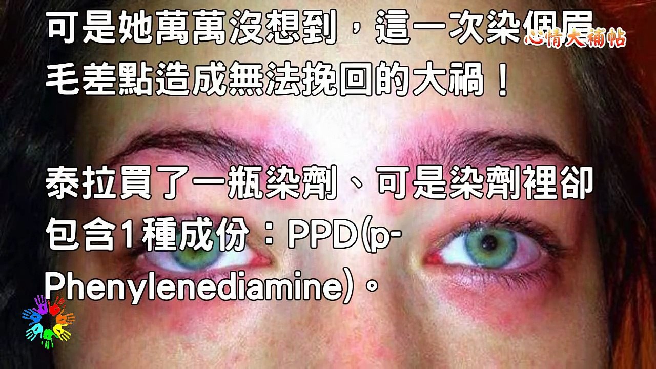 她一早起床發現「滿眼都是膿」痛得尖叫！全因爲她前一晚...！很多人都會用！