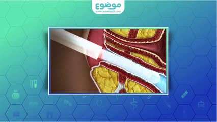 #موضوع: متى يظهر نبض الجنين؟