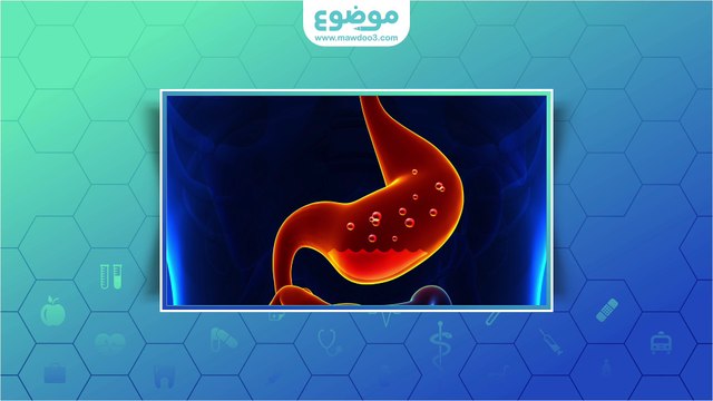 #موضوع: كيف تتخلص الحامل من الحموضة؟