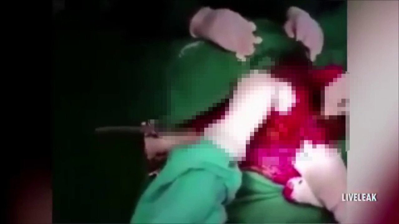 Roket tertusuk pada punggung, lelaki selamat dibedah