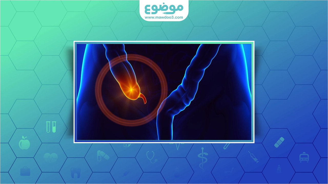#موضوع: أسباب التهاب الزائدة الدودية