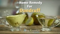 Dandruff Treatment At Home | Dandruff Home Remedies | Home Remedies With Upasana