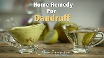 Download Video: Dandruff Treatment At Home | Dandruff Home Remedies | Home Remedies With Upasana