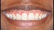 West Frisco Dental And Implants - (972) 607-3847 - west frisco dentis