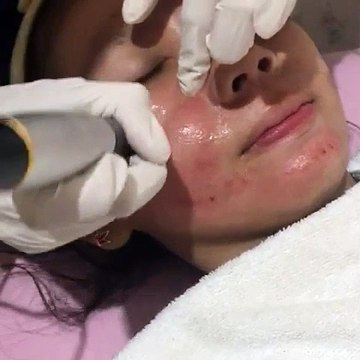 0811 1721 280, Agar Dagu Terbelah dekat Tebet Rinanda Skin Care Center