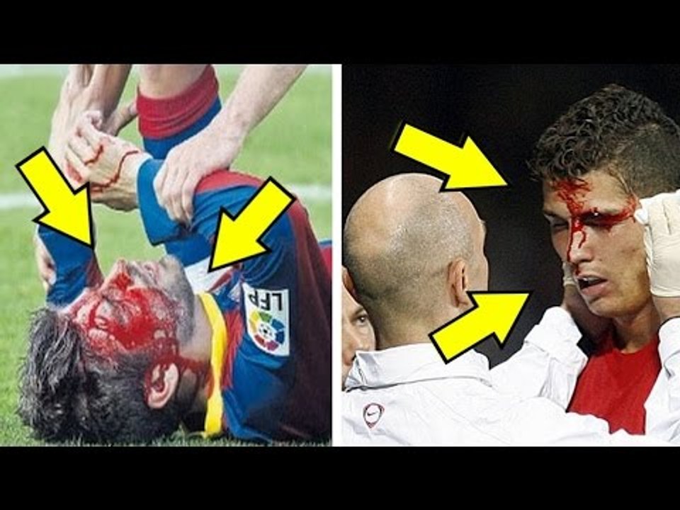 أخطر الإصابات التي تعارض لها ميسي و رونالدو